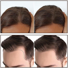 06_hairline_9645232c-0377-4c35-b9f2-c070acb396d4 - Indigenous Shop